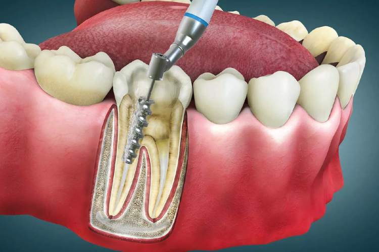Dental (1)