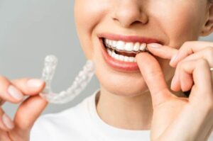 Clear Aligners vs Braces