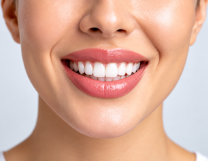 Full Mouth Rehabilitation in Madurai