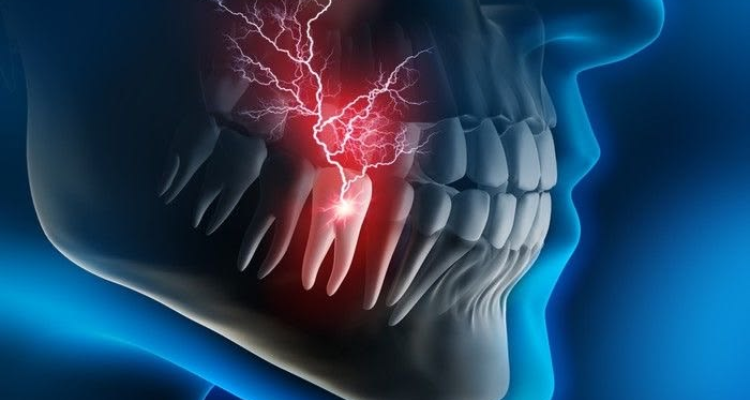 root-canal-3 (1)