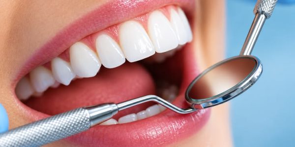 full-mouth-rehabilitation-blog1
